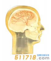 美国RSD 血管造影头部模型