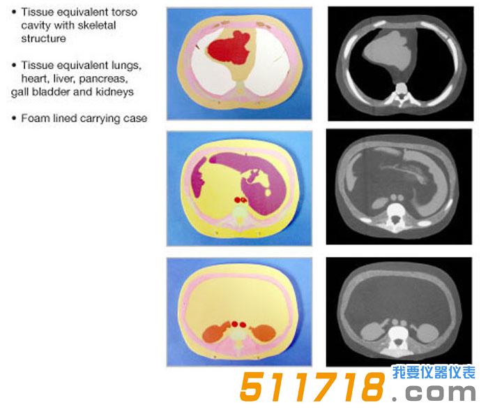 1534930647972879.jpg 美国CIRS 600 3D截面躯干模型模体.jpg