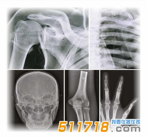 德国QUART全身X射线模体.jpg 德国QUART全身X射线模体.jpg